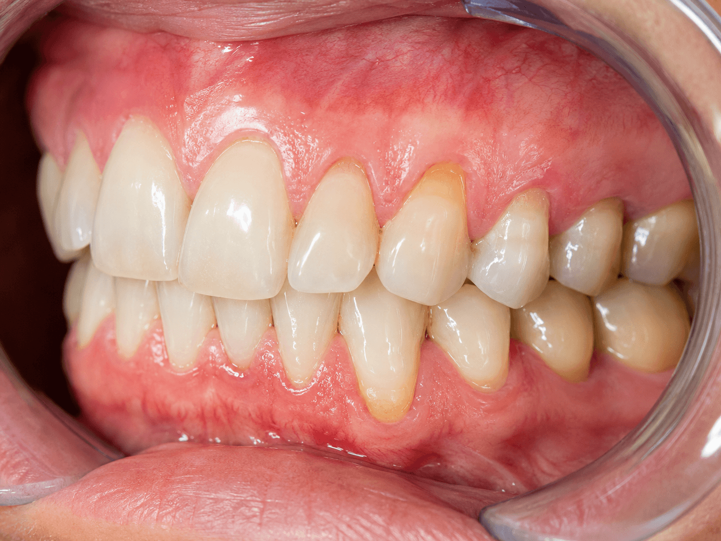 Menopause and oral health detail 2