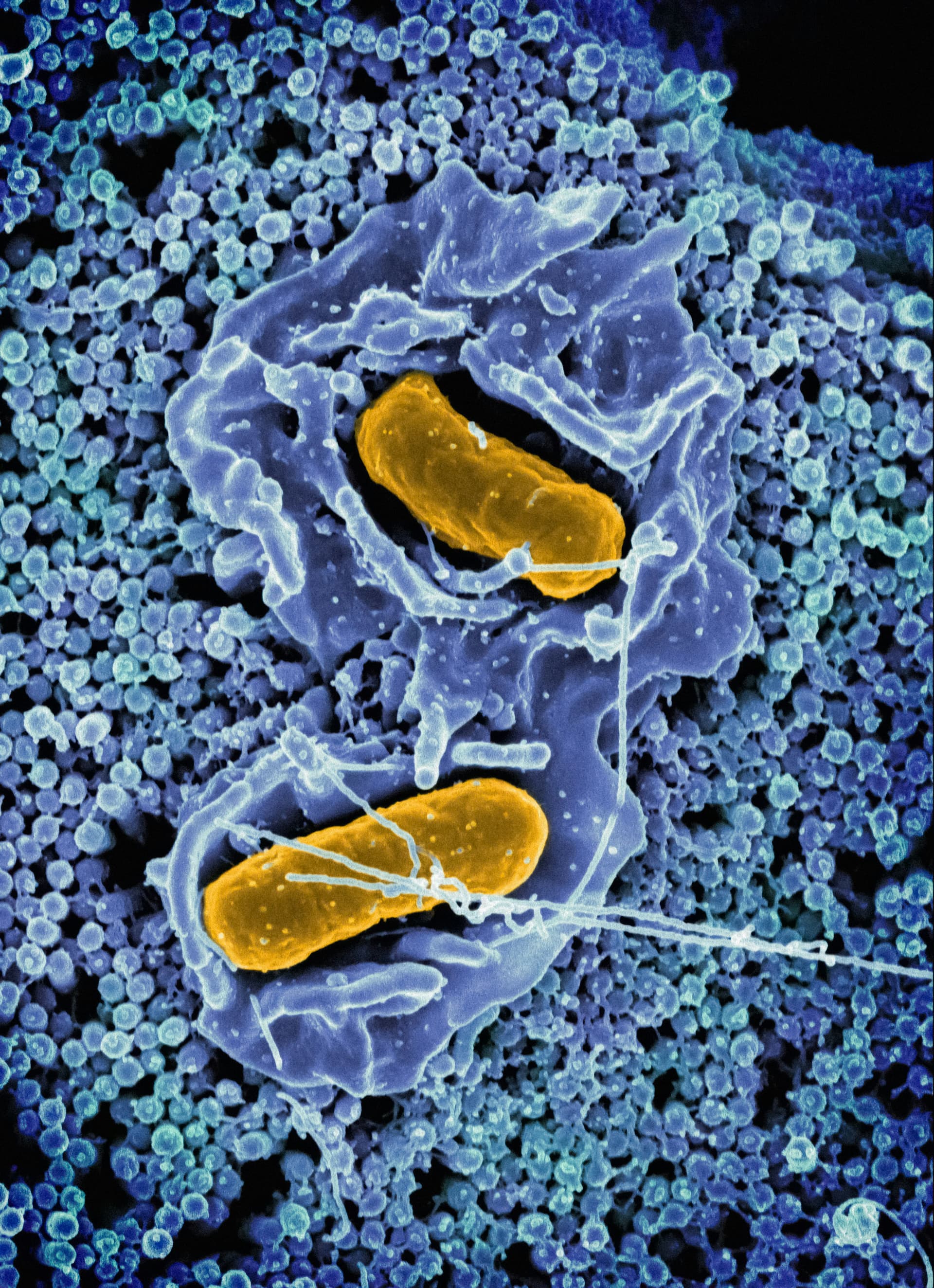 The oral microbiome and overall health detail 1