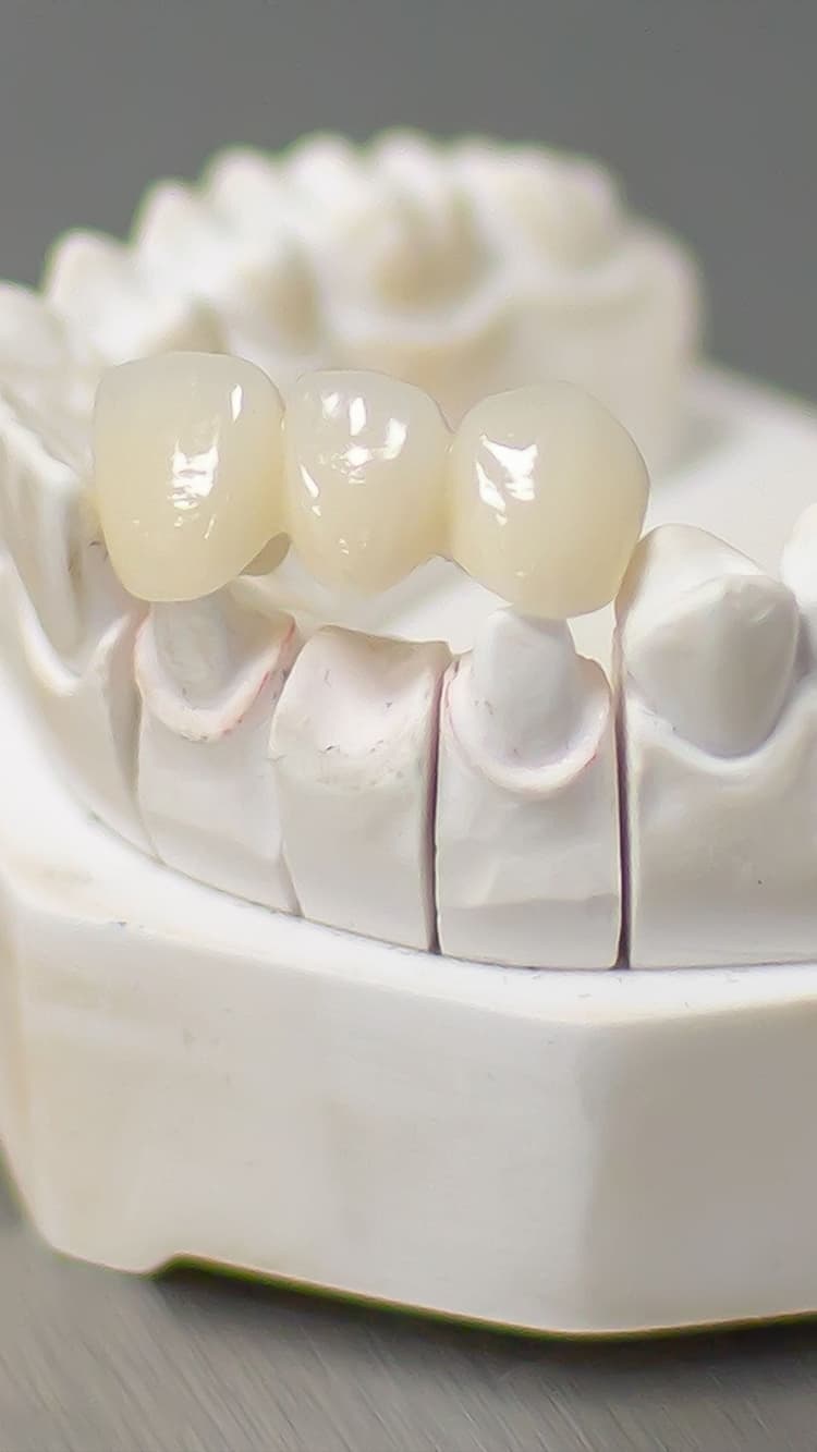 Crowns