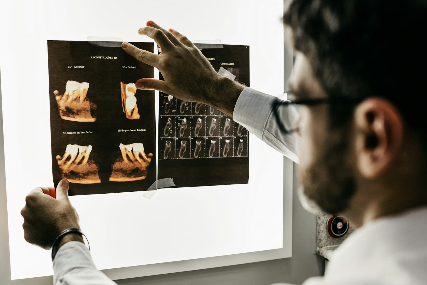 Dentist reviewing a digital scan for full-arch implant planning